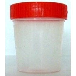 FRASCO MUESTRA ESTERIL 100ML